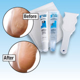 Callous Clear Foot Treatment Kit Deluxe