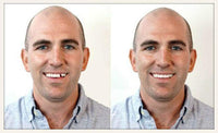 Instant Smile Select A Tooth Temporary Tooth Replacement Kit- Combo