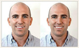 Instant Smile Select A Tooth Temporary Tooth Replacement Kit- Combo