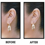 Ear Lift Medical Ear Support