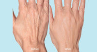 Ageless Hands Intensive Therapy by Biologic Solutions (2 fl oz)