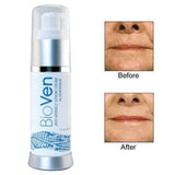 Bioven: Anti-Wrinkle Venom Cream by Genesphere (1 fl. oz.) - Set of 2