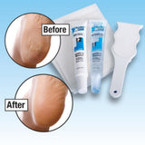 Callous Clear Foot Treatment Kit
