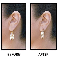 EarLift Invisible Ear Lobe Support Solution