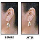 EarLift Invisible Ear Lobe Support Solution